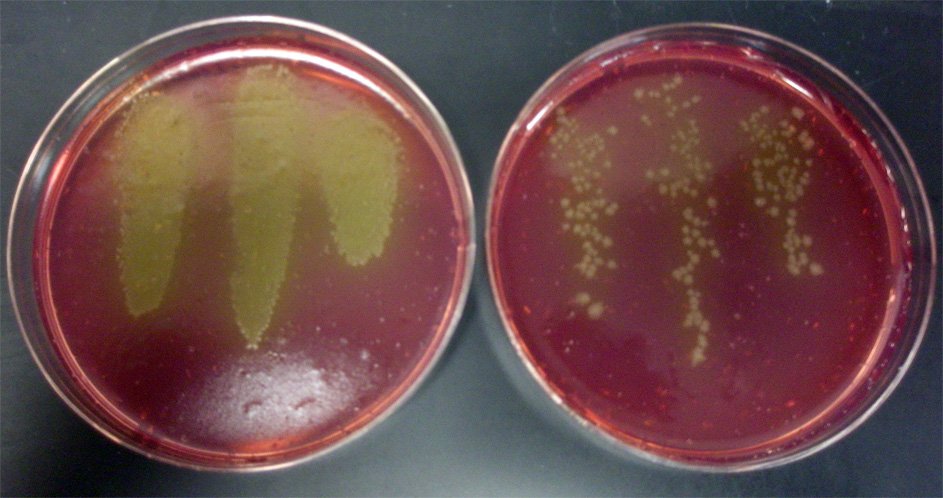 hand prints with C.diff